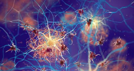 alzheimers_stem_cell_therapy.jpg